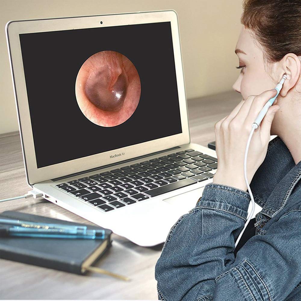 Ear Cleaning Endoscope with 0.3MP Camera and 6 LED
