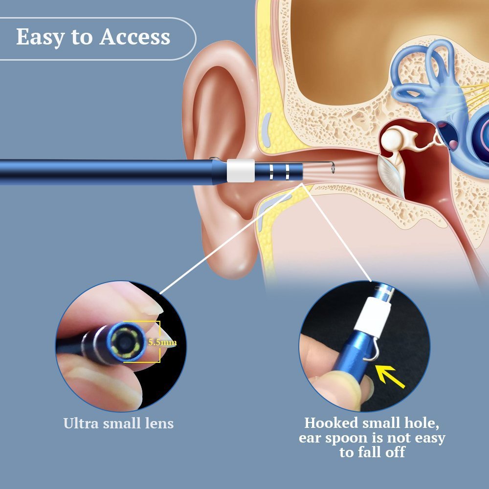 Ear Cleaning Endoscope with 0.3MP Camera and 6 LED amiciKart