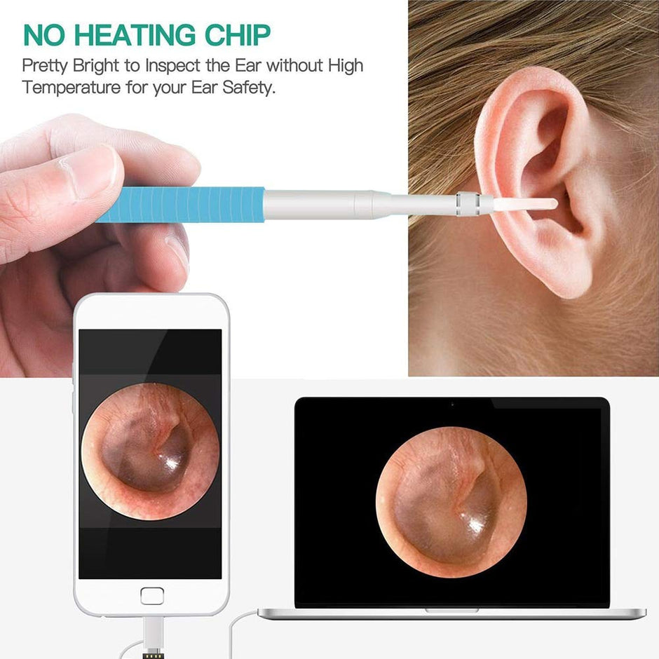 Ear Cleaning Endoscope with 0.3MP Camera and 6 LED amiciKart c0tmiz-hs.myshopify.com